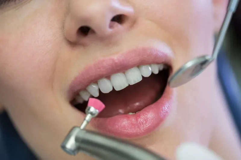 Contemporary Approaches To Teeth Whitening And Smile Enhancement Care